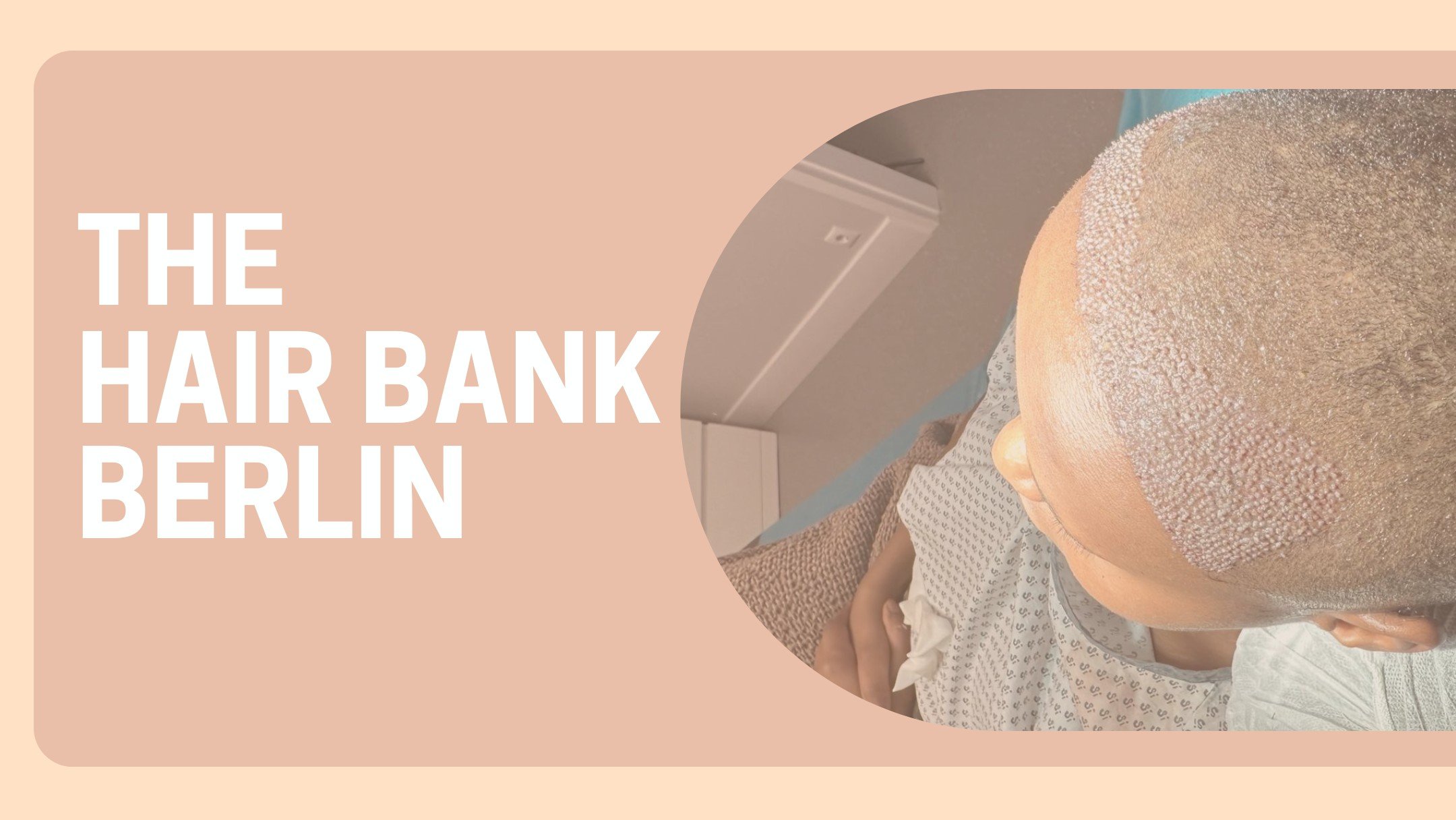 Haartransplantation in Berlin (2)